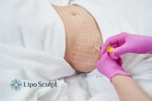 Are The Results From Aqualyx Permanent? 1 Do you want to know how long Aqualyx Brackley results last?