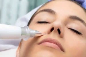 Best Actinic Keratoses Removal 3 Actinic keratoses Brackley solutions - book in today!