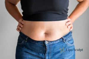 Bidding Farewell to Muffin Tops with Aqualyx Fat Injections 2 Do you wish you could reduce your muffin top Brackley With Aqualy fat dissolving injections you can!
