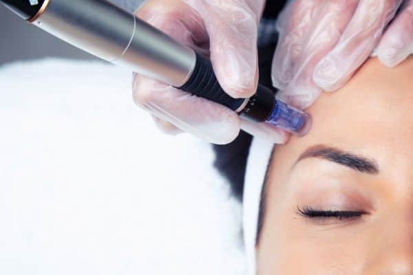 Explaining Total Skin Tightening Treatment and What to Expect 2 What Skin Concerns Can Total Skin Tightening Treatment Help With Brackley?